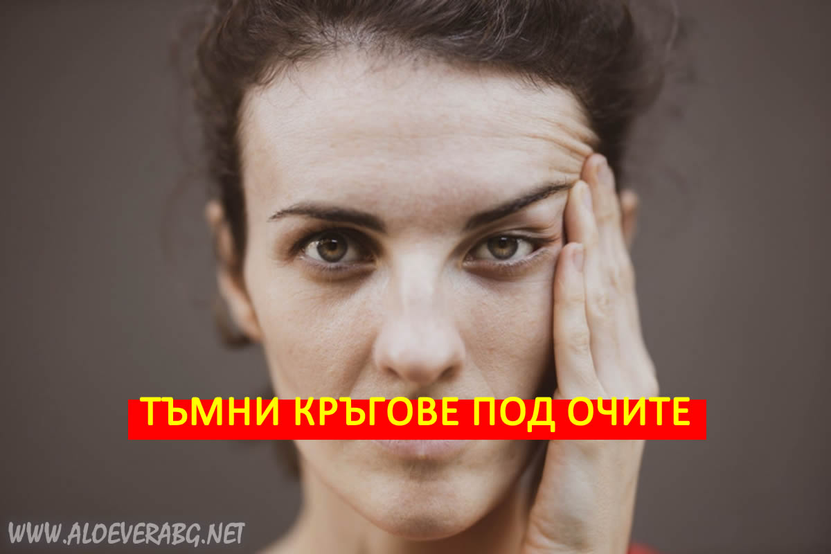 Тъмни кръгове под очите - Вижте 5 причини за появата им!