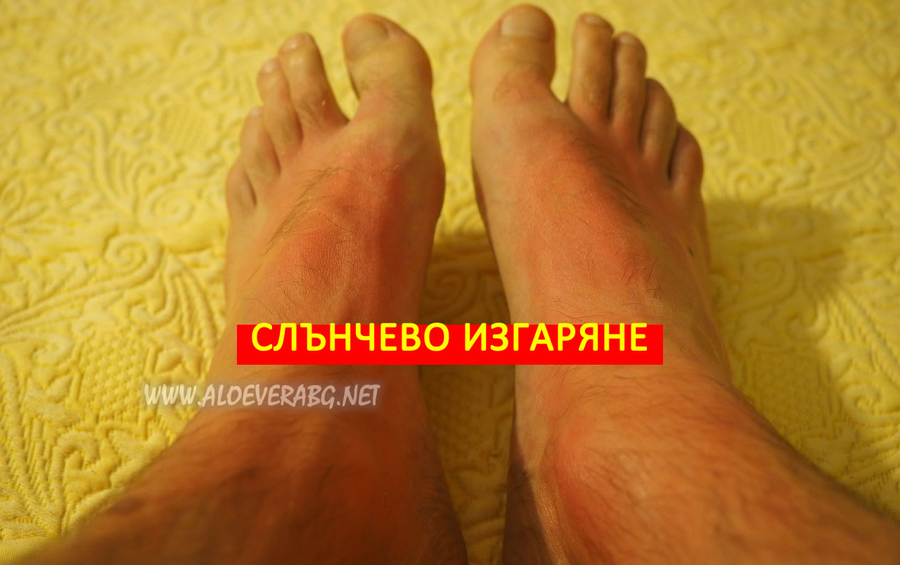 slanchevo izgarianel