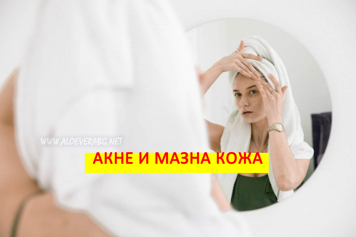 Акне и Мазна кожа - 7 домашни средства, които ще ви помогнат да се справите!