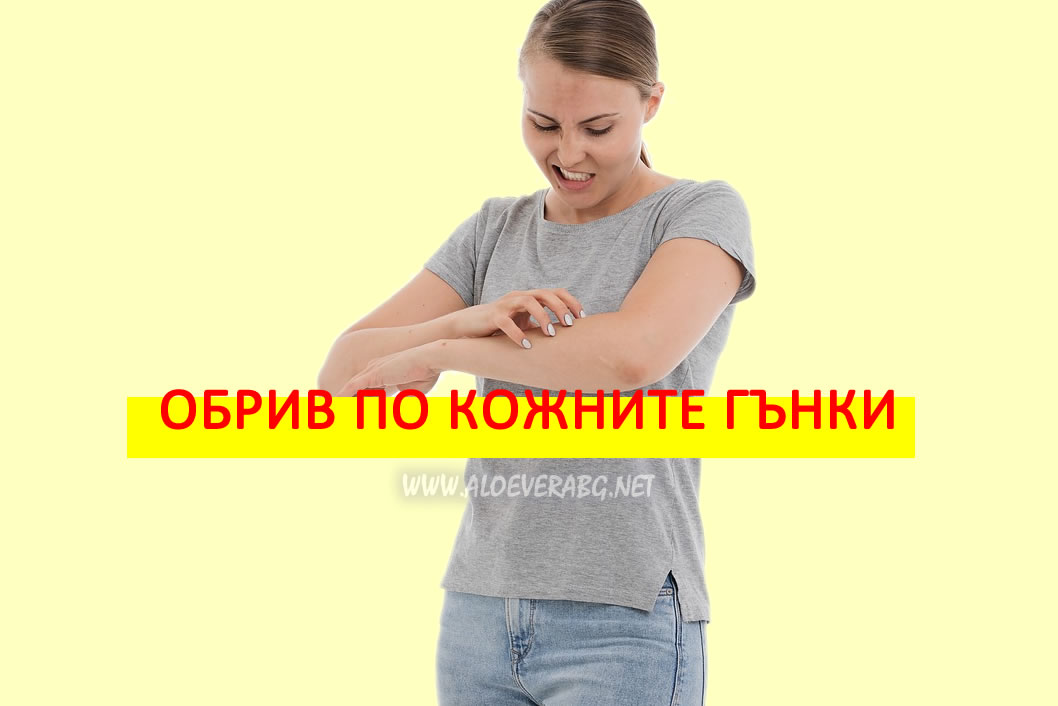 Обрив по кожните гънки (Интертриго) - Симптоми и Лечение!