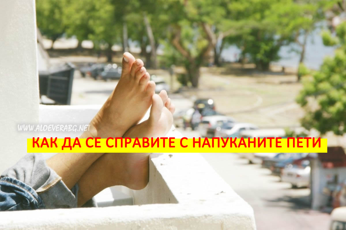 Напукани пети! Вижте какви са причините и как да се справите!