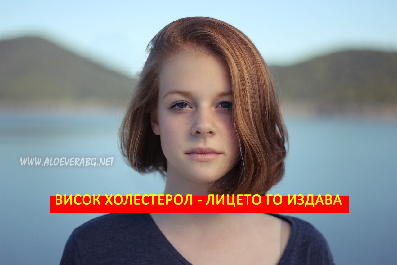 Висок холестерол - Вижте как симптомите се проявяват на лицето!