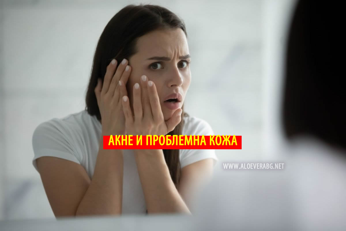 Акне и проблемна кожа - Вижте 5 билки, които помагат!