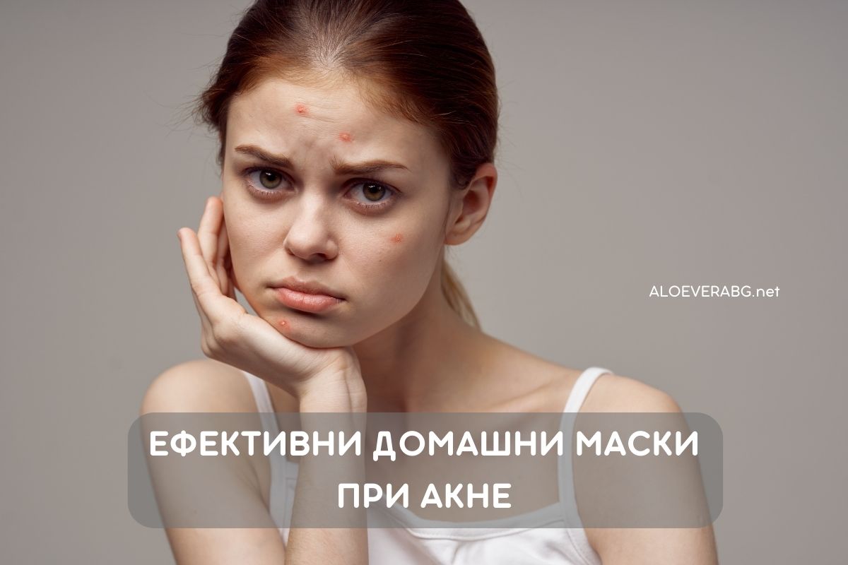Акне и Мазна Кожа - Вижте 3 Ефективни Маски!
